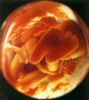 Filename=19-22wk.jpg
Filesize=16KB
Dimensions=240x269
Date added=Oct 04, 2006 19-22wk.jpg