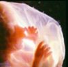 Filename=26-28wk.jpg
Filesize=7KB
Dimensions=180x177
Date added=Oct 04, 2006 26-28wk.jpg