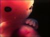Filename=8wk.jpg
Filesize=5KB
Dimensions=180x135
Date added=Oct 04, 2006 8wk.jpg